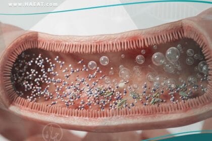 عدم تحمل اللاكتوز