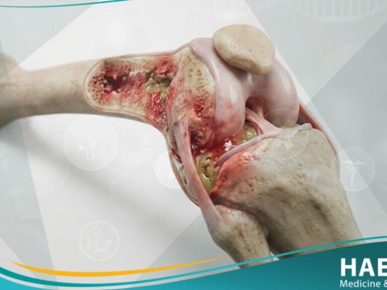 عدوى العظام والمفاصل لدى الأطفال