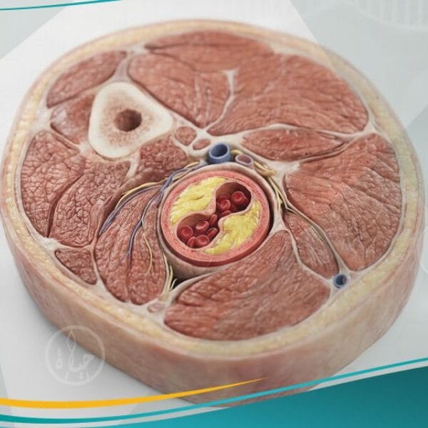 عرج متقطع (1)