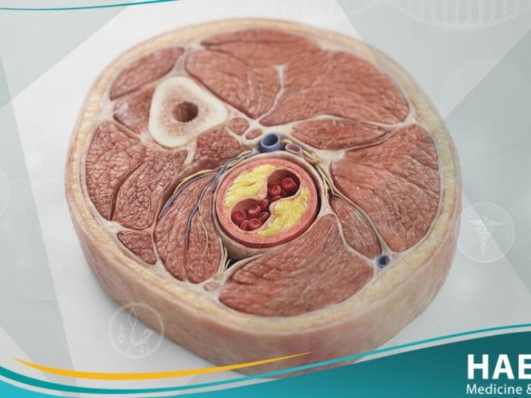 عرج متقطع (1)