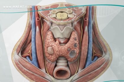 _عقيدات الغدة الدرقية