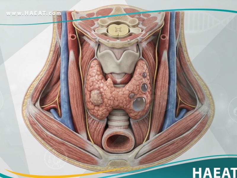_عقيدات الغدة الدرقية