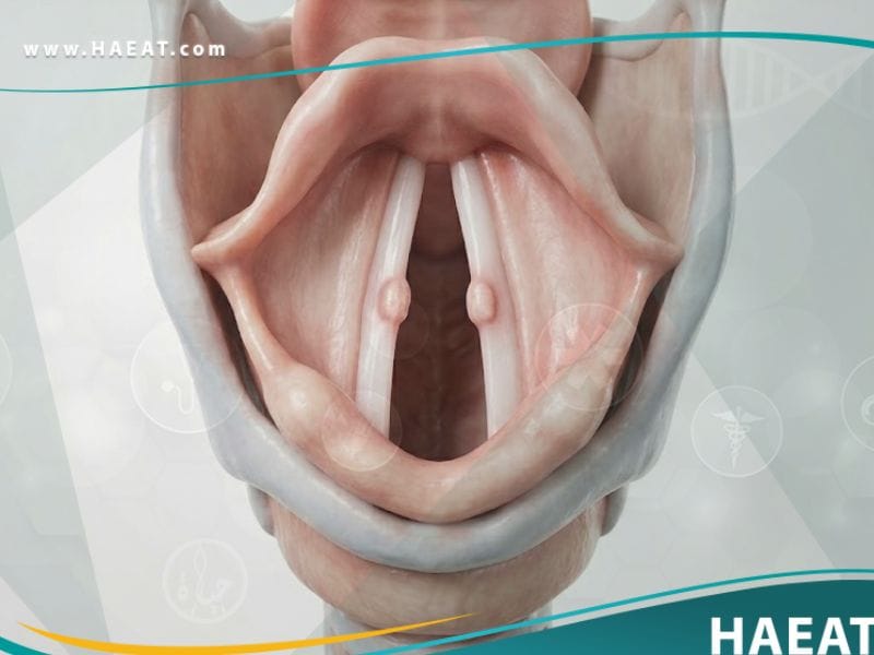 عقيدات وأورام الحنجرة الحميدة