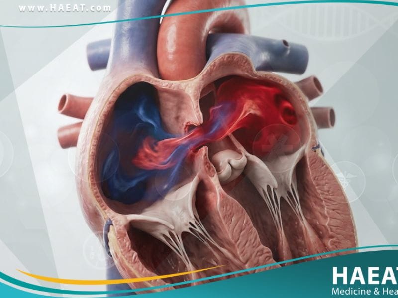 عيوب الحاجز الأذيني