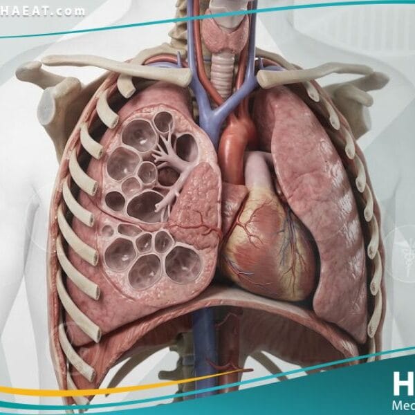 _عيوب الرئة الخلقية