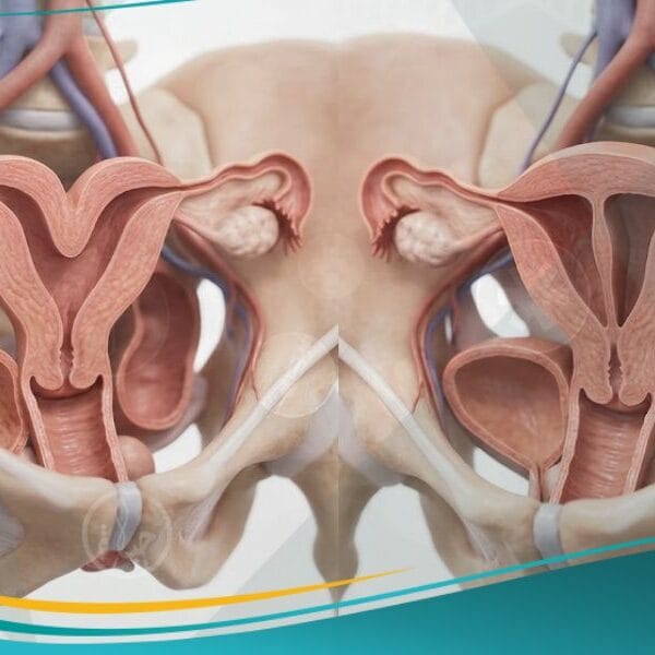 عيوب خلقية في الجهاز التناسلي