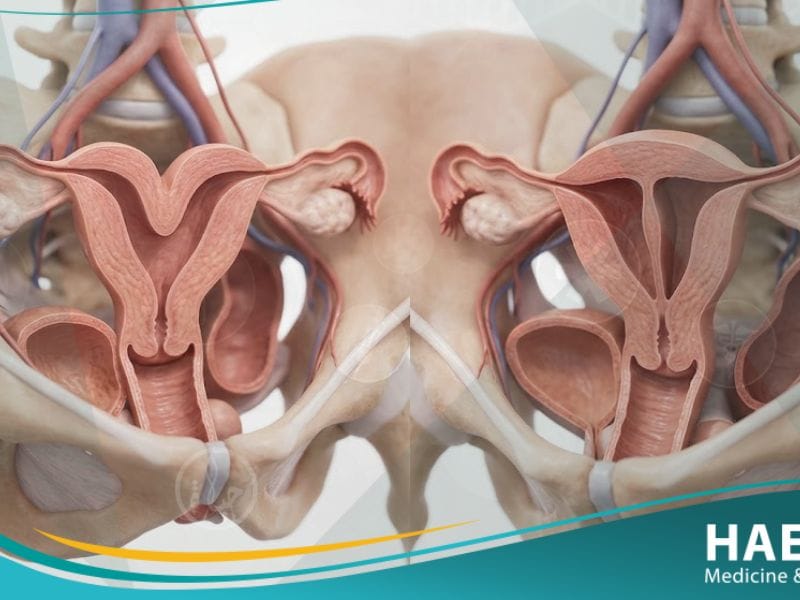 عيوب خلقية في الجهاز التناسلي