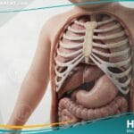 فتق حجابي خلقي