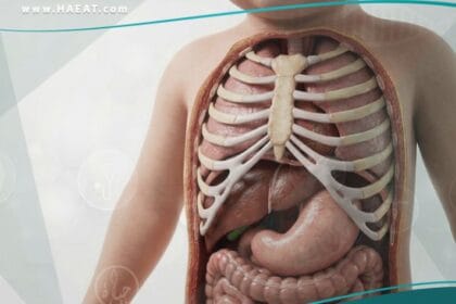 فتق حجابي خلقي