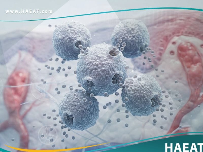 _فرط التحسس