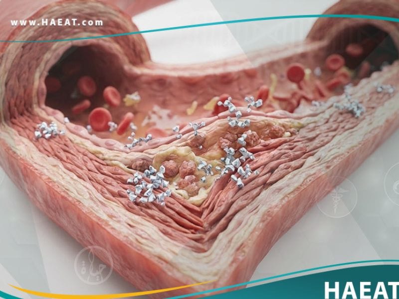 فرط الهوموسستئين في الدم