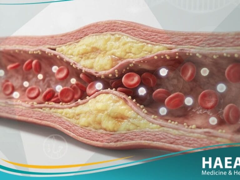 فرط شحميات الدم لدى مرضى السكري