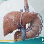 فرط ضغط الدم البابي