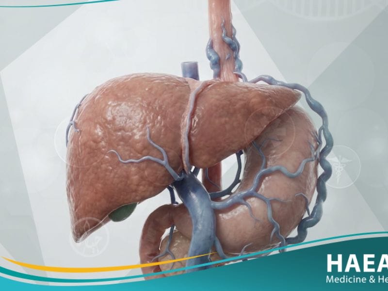 فرط ضغط الدم البابي