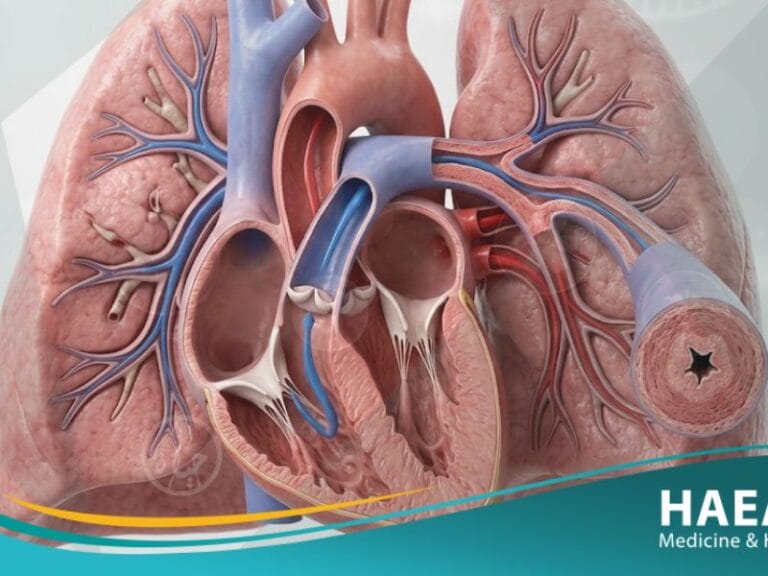 فرط ضغط الدم الرئوي