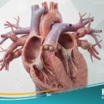 _فشل القلب الاحتقاني