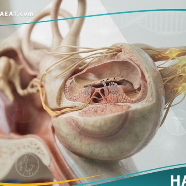 فقدان السمع في الأذن الباطنة