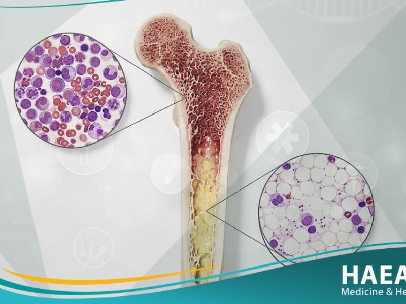 فقر الدم اللاتنسجي