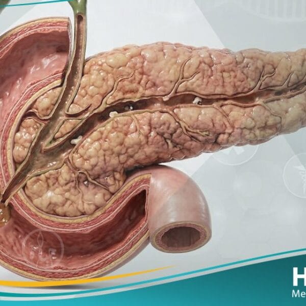 قصور البنكرياس