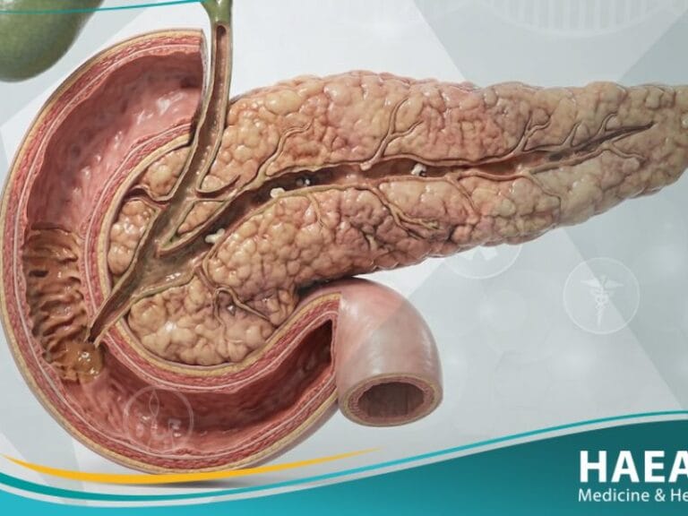 قصور البنكرياس