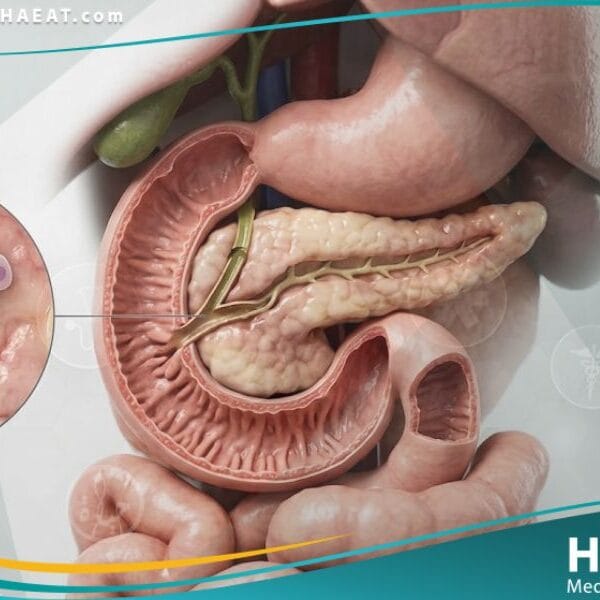 قصور البنكرياس لدى الأطفال