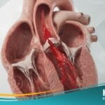 _قلس الأبهري