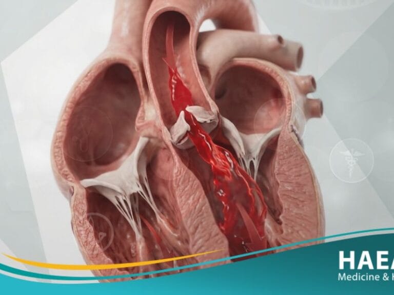 _قلس الأبهري