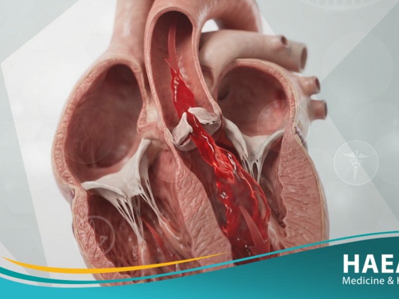 _قلس الأبهري