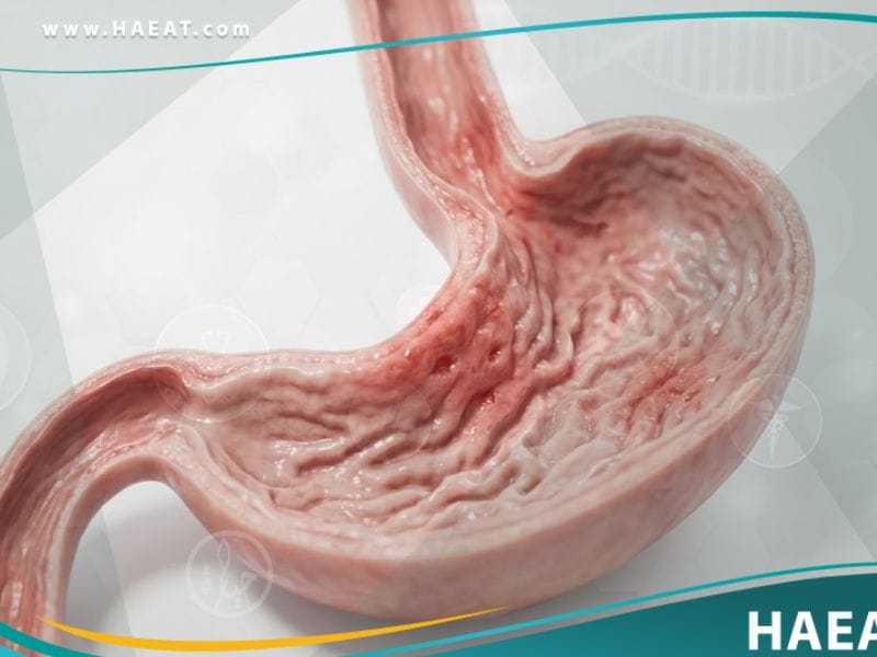 قيء الدم لدى حديثي الولادة