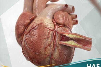 كربة تاجية حادة