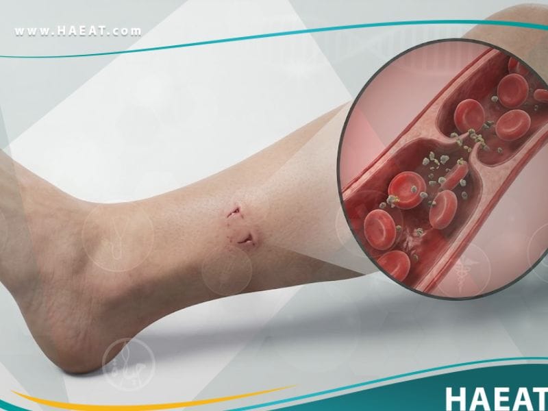 _لدغة الثعبان