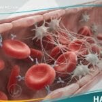 _متلازمة أضداد الشحوم الفوسفورية