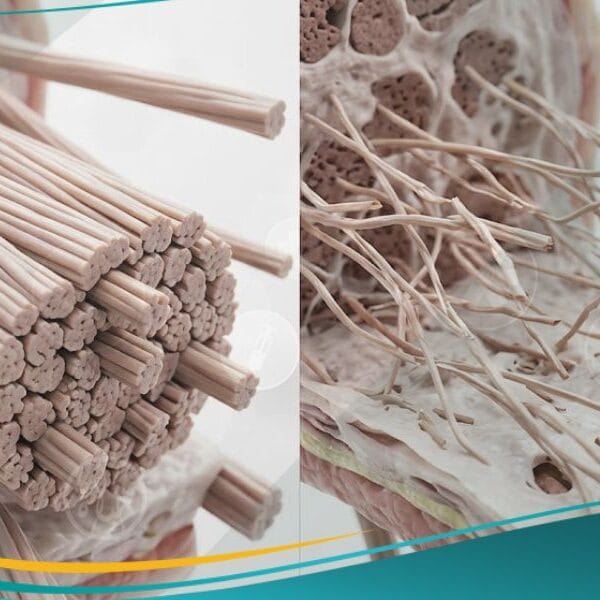 متلازمة إهلر دانلوس (1)