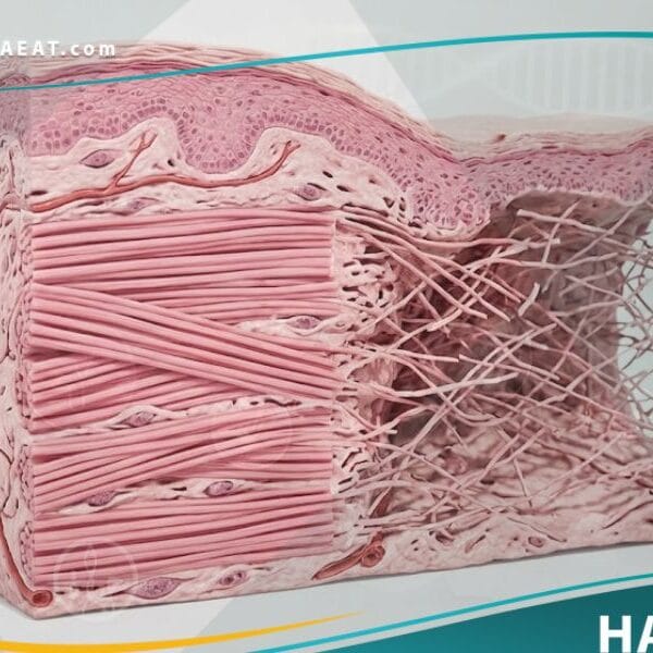 متلازمة إهلر دانلوس