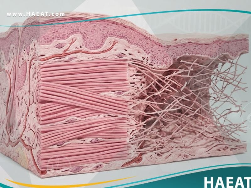 متلازمة إهلر دانلوس