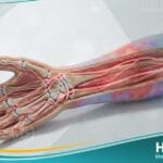 متلازمة الألم الإقليمية المعقدة