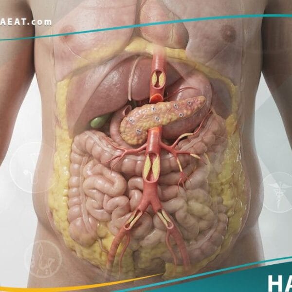 _متلازمة الأيض