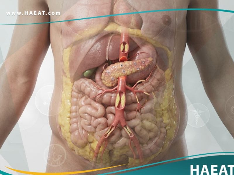 _متلازمة الأيض