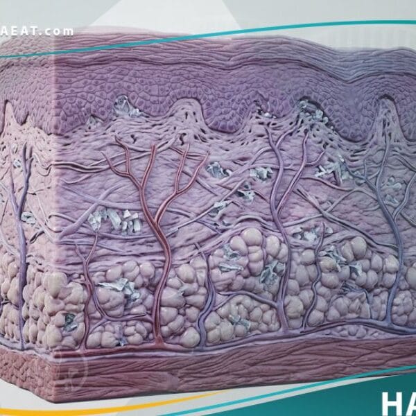 _متلازمة الإصابة البردية