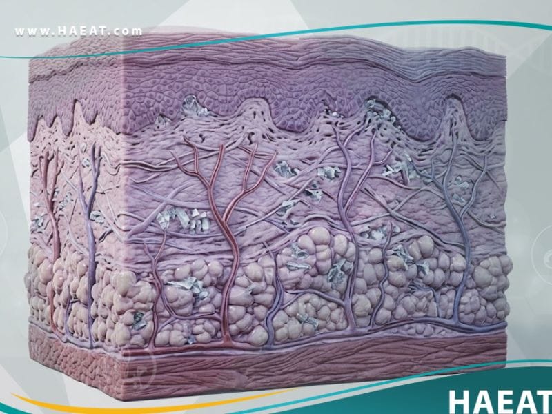 _متلازمة الإصابة البردية