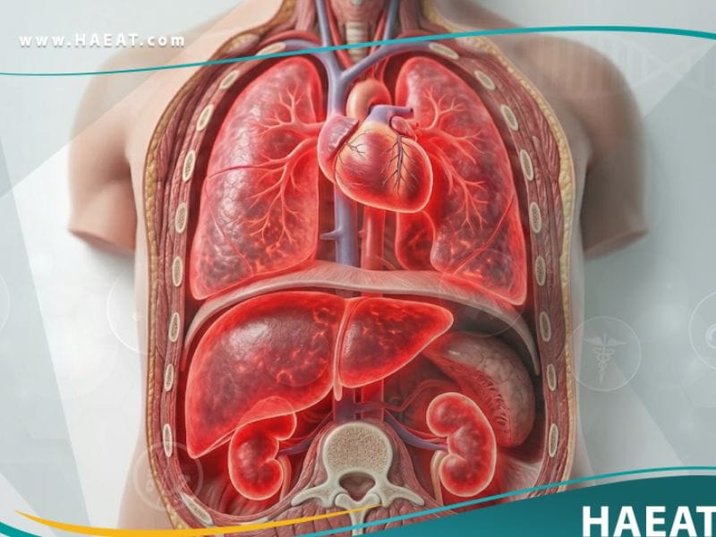 متلازمة الفشل متعدد الأجهزة