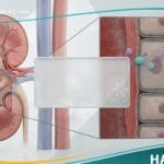 متلازمة بارتر