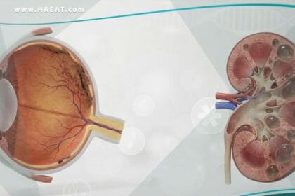 متلازمة بارديت - بيدل (1)