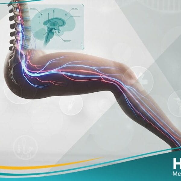 _متلازمة تململ الساقين