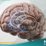 متلازمة توريت