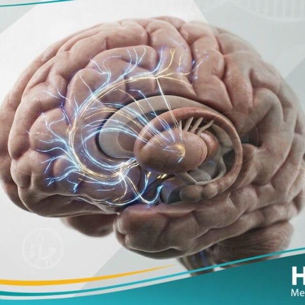 متلازمة توريت