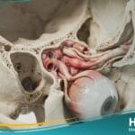 متلازمة تولوزا هنت