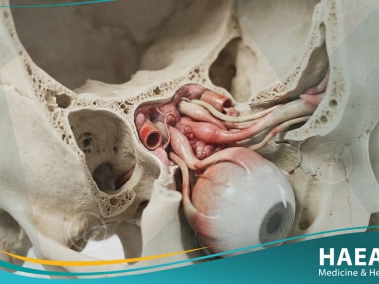 متلازمة تولوزا هنت