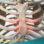 متلازمة تيتز (1)