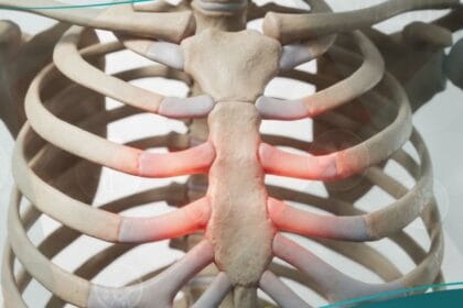 متلازمة تيتز (1)
